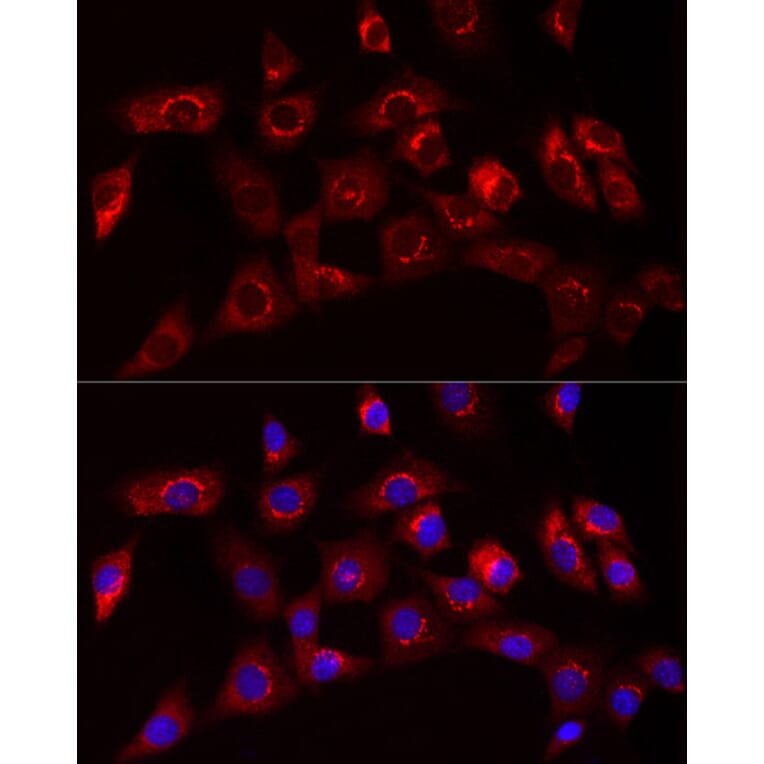 Immunofluorescence - Anti-Collagen I Antibody (A11439) - Antibodies.com