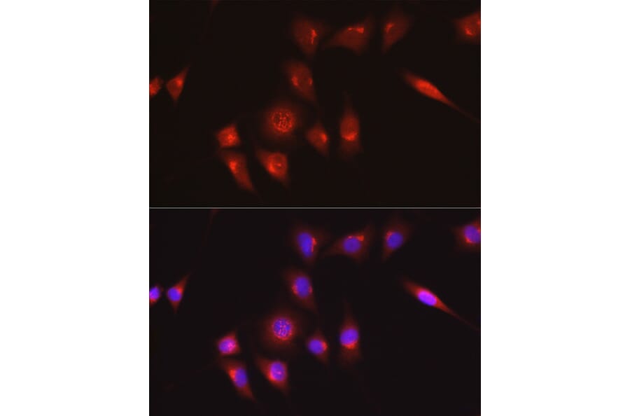 Immunofluorescence - Anti-Collagen I Antibody (A11439) - Antibodies.com
