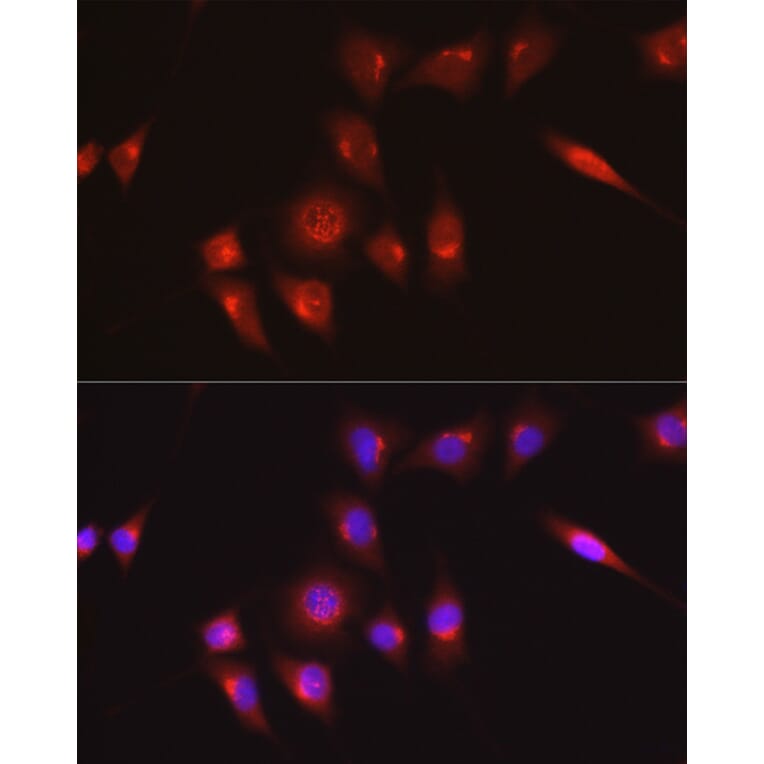 Immunofluorescence - Anti-Collagen I Antibody (A11439) - Antibodies.com