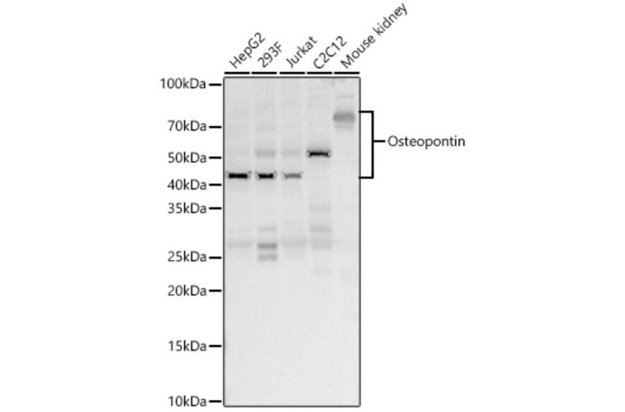 Western Blot - Anti-Osteopontin Antibody (A11441) - Antibodies.com