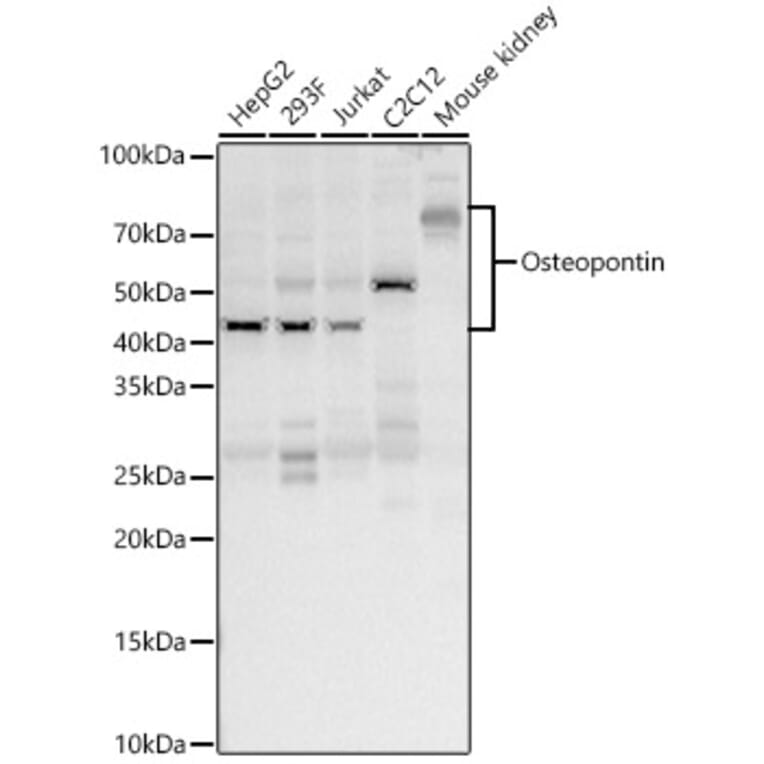Western Blot - Anti-Osteopontin Antibody (A11441) - Antibodies.com