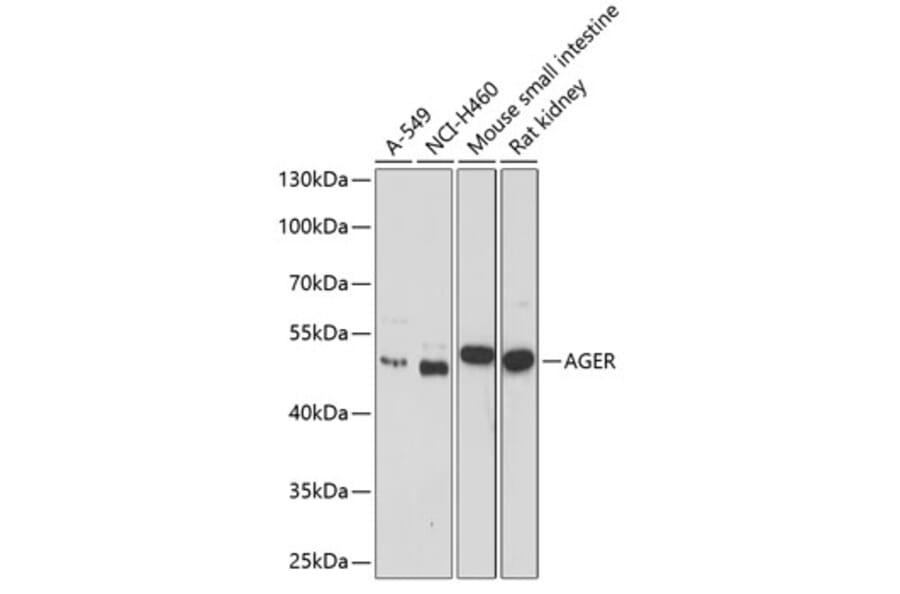 Western Blot - Anti-RAGE Antibody (A11444) - Antibodies.com