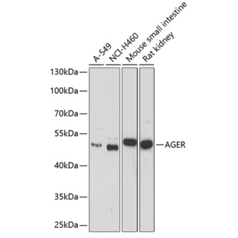 Western Blot - Anti-RAGE Antibody (A11444) - Antibodies.com