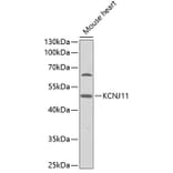 Western Blot - Anti-KCNJ11 Antibody (A1417) - Antibodies.com