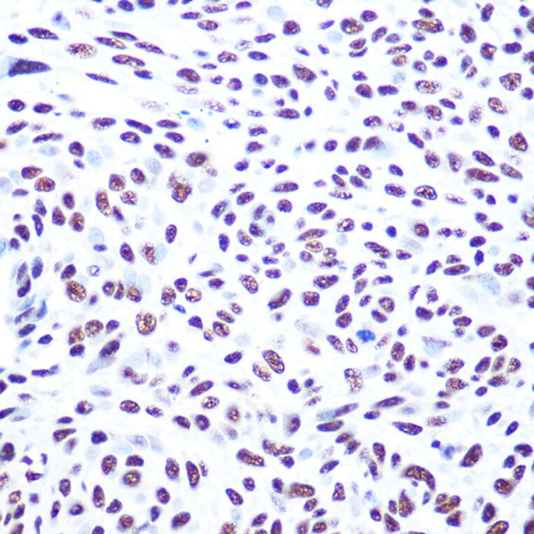 Immunohistochemistry - Anti-DNA PKcs Antibody (A11446) - Antibodies.com