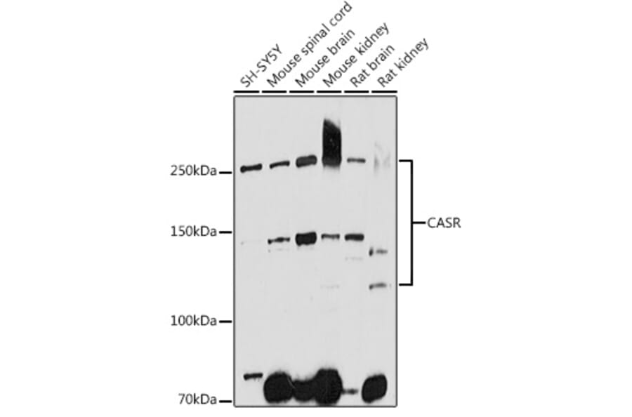 Western Blot - Anti-CaSR Antibody (A11447) - Antibodies.com