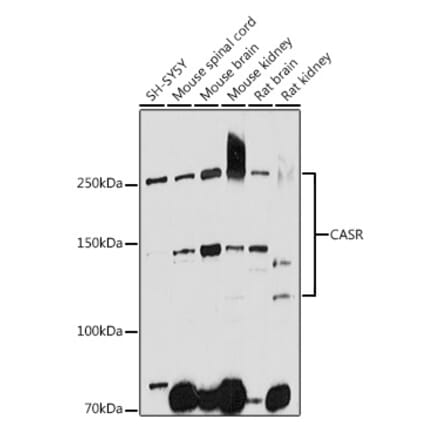 Western Blot - Anti-CaSR Antibody (A11447) - Antibodies.com