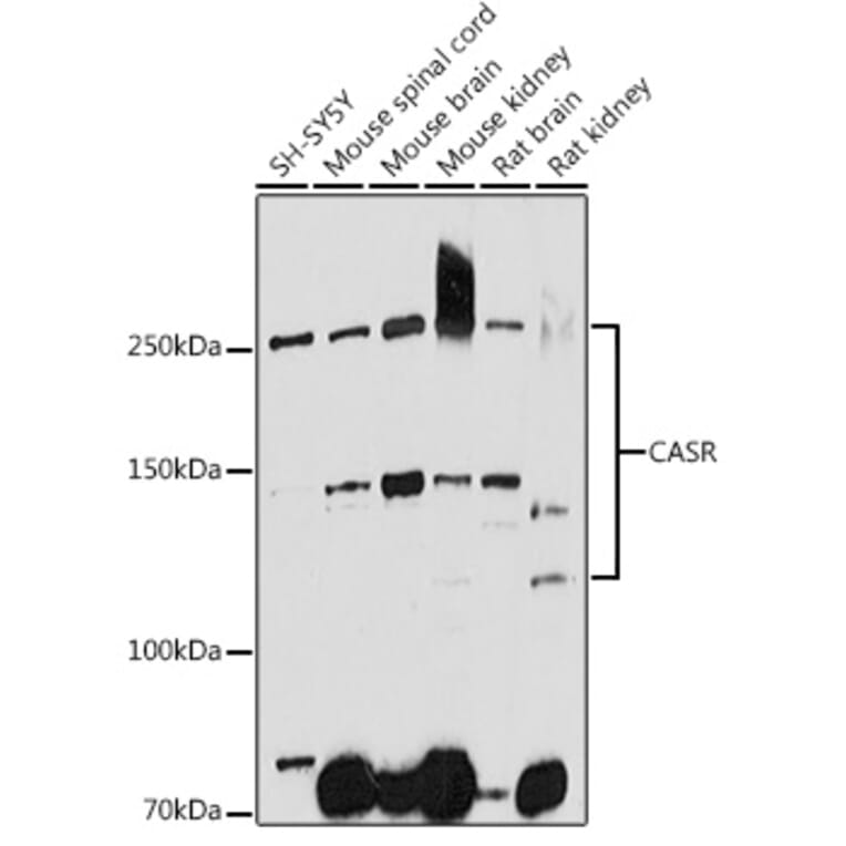 Western Blot - Anti-CaSR Antibody (A11447) - Antibodies.com