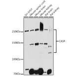 Western Blot - Anti-CaSR Antibody (A11447) - Antibodies.com