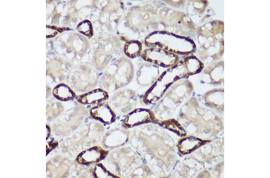 Immunohistochemistry - Anti-CaSR Antibody (A11447) - Antibodies.com