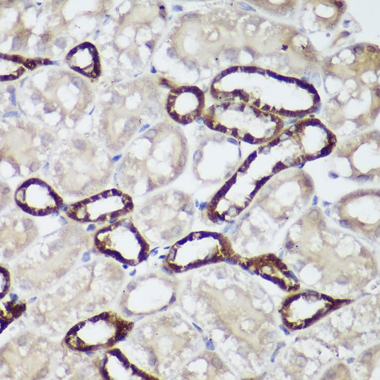 Immunohistochemistry - Anti-CaSR Antibody (A11447) - Antibodies.com