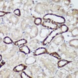 Immunohistochemistry - Anti-CaSR Antibody (A11447) - Antibodies.com