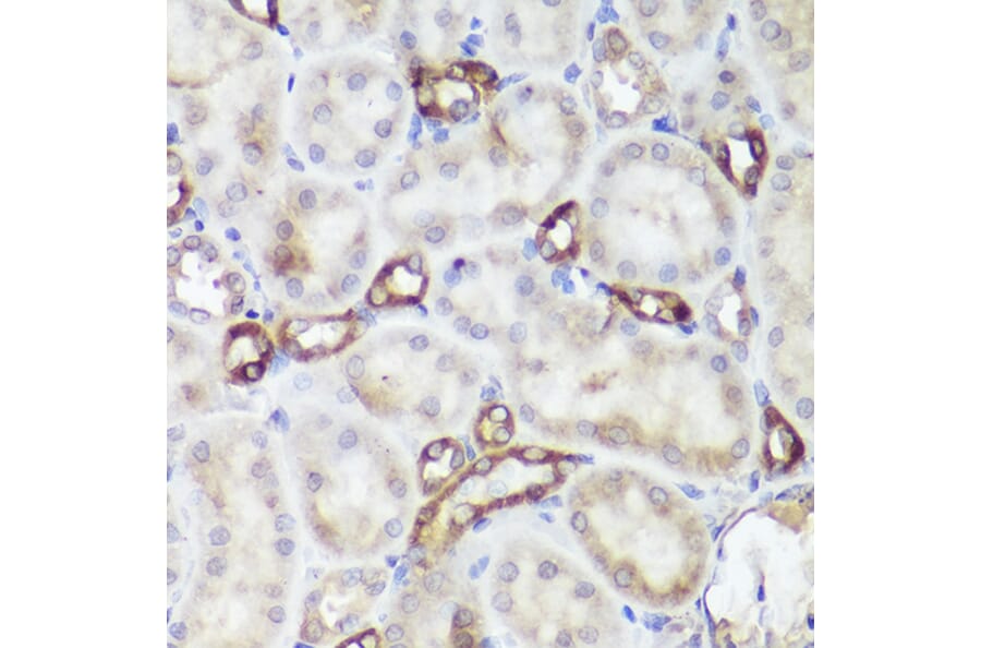 Immunohistochemistry - Anti-CaSR Antibody (A11447) - Antibodies.com