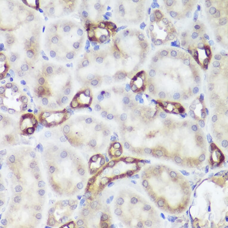 Immunohistochemistry - Anti-CaSR Antibody (A11447) - Antibodies.com