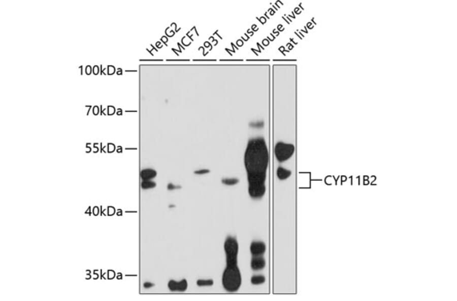 Western Blot - Anti-C11B2/CYP11B2 Antibody (A11449) - Antibodies.com