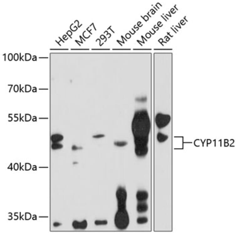 Western Blot - Anti-C11B2 / CYP11B2 Antibody (A11449) - Antibodies.com