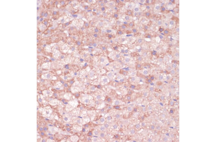 Immunohistochemistry - Anti-C11B2/CYP11B2 Antibody (A11449) - Antibodies.com