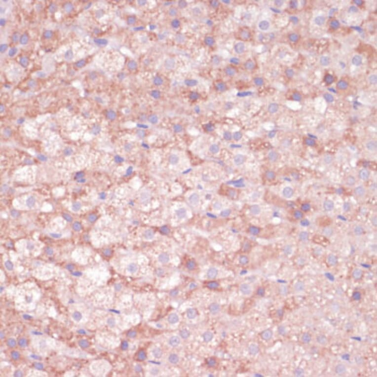 Immunohistochemistry - Anti-C11B2 / CYP11B2 Antibody (A11449) - Antibodies.com