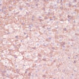 Immunohistochemistry - Anti-C11B2 / CYP11B2 Antibody (A11449) - Antibodies.com