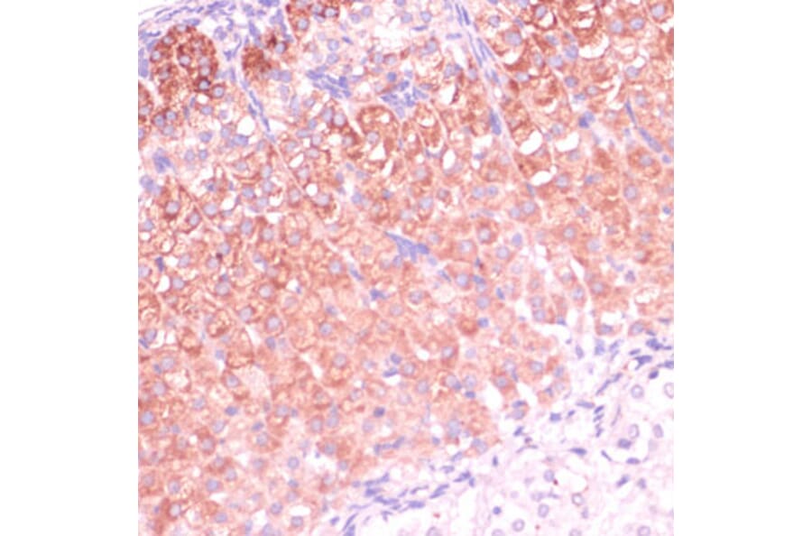 Immunohistochemistry - Anti-C11B2/CYP11B2 Antibody (A11449) - Antibodies.com
