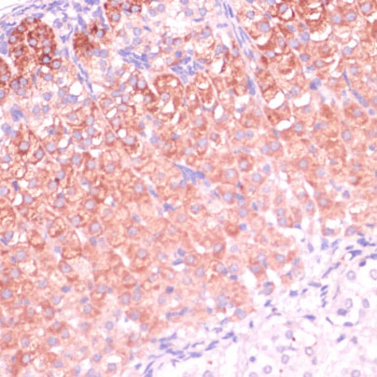 Immunohistochemistry - Anti-C11B2 / CYP11B2 Antibody (A11449) - Antibodies.com