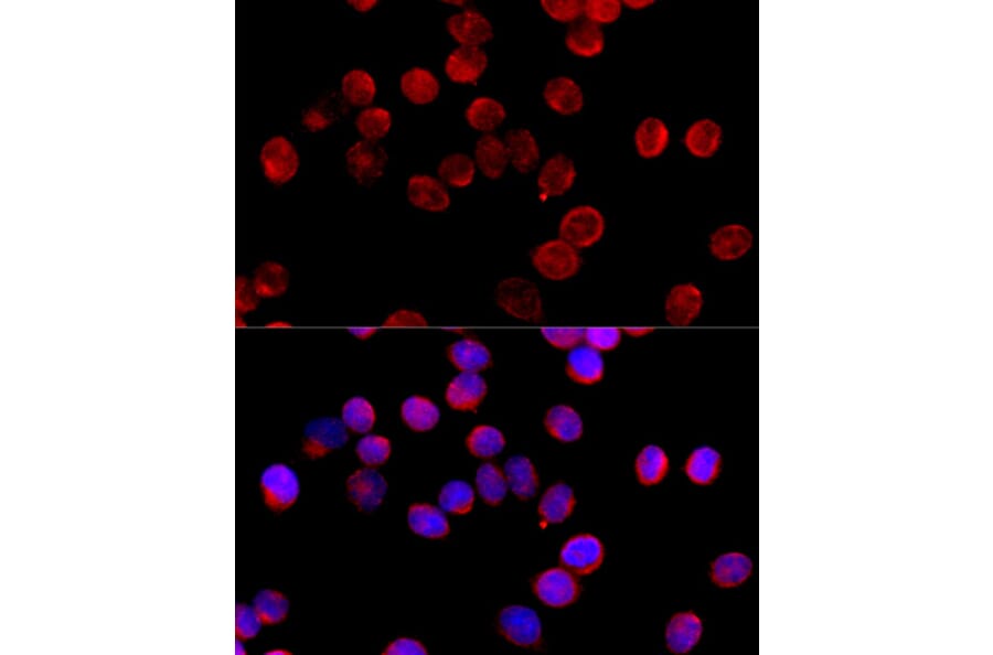 Immunofluorescence - Anti-C11B2/CYP11B2 Antibody (A11449) - Antibodies.com