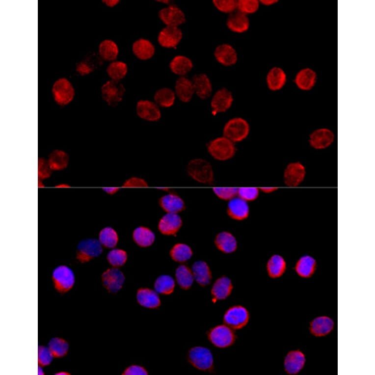 Immunofluorescence - Anti-C11B2 / CYP11B2 Antibody (A11449) - Antibodies.com