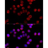 Immunofluorescence - Anti-C11B2 / CYP11B2 Antibody (A11449) - Antibodies.com