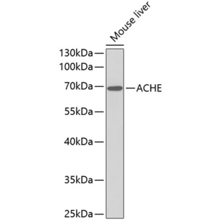 Western Blot - Anti-ACHE Antibody (A1454) - Antibodies.com