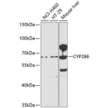Western Blot - Anti-Cytochrome P450 2B6 / CYP2B6 Antibody (A11451) - Antibodies.com