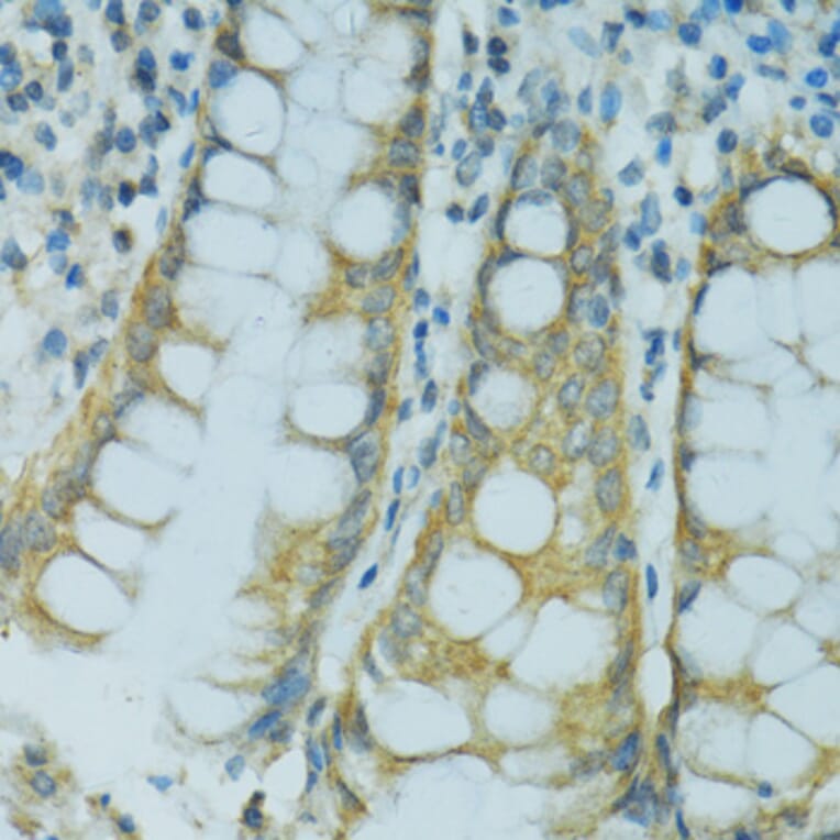 Immunohistochemistry - Anti-Cytochrome P450 2B6 / CYP2B6 Antibody (A11451) - Antibodies.com