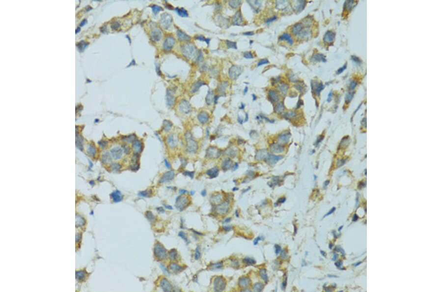 Immunohistochemistry - Anti-Cytochrome P450 2B6 / CYP2B6 Antibody (A11451) - Antibodies.com