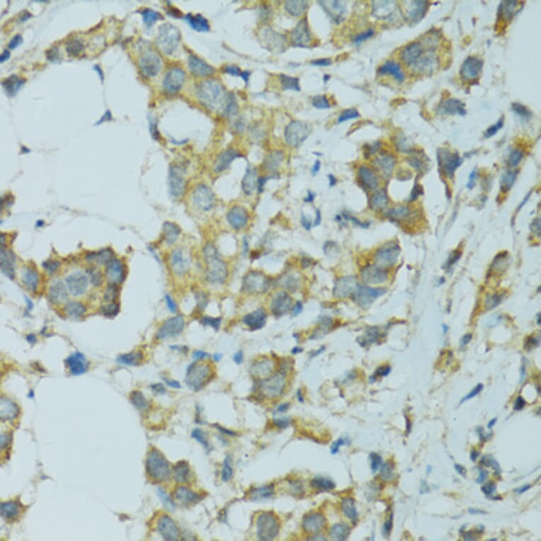 Immunohistochemistry - Anti-Cytochrome P450 2B6 / CYP2B6 Antibody (A11451) - Antibodies.com
