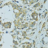 Immunohistochemistry - Anti-Cytochrome P450 2B6 / CYP2B6 Antibody (A11451) - Antibodies.com