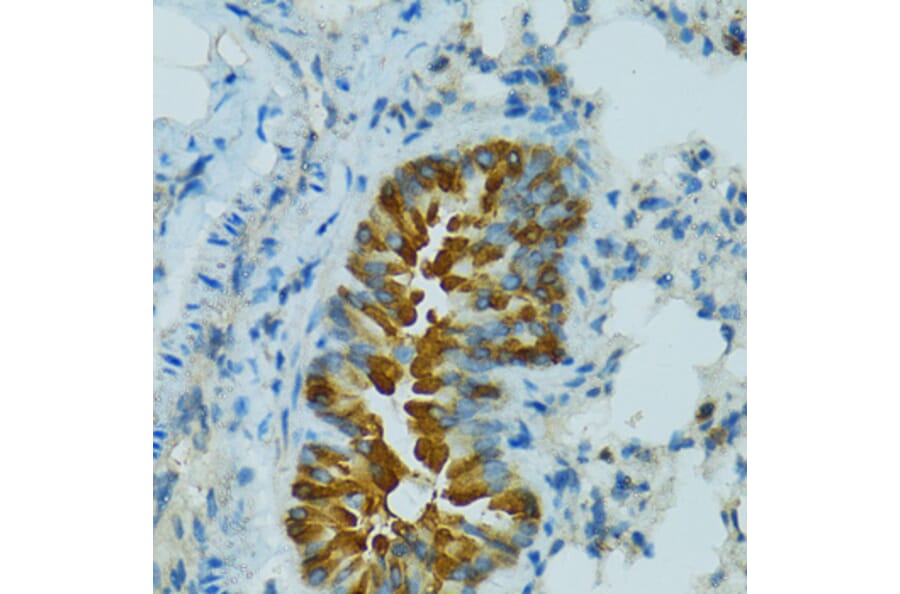 Immunohistochemistry - Anti-Cytochrome P450 2B6 / CYP2B6 Antibody (A11451) - Antibodies.com