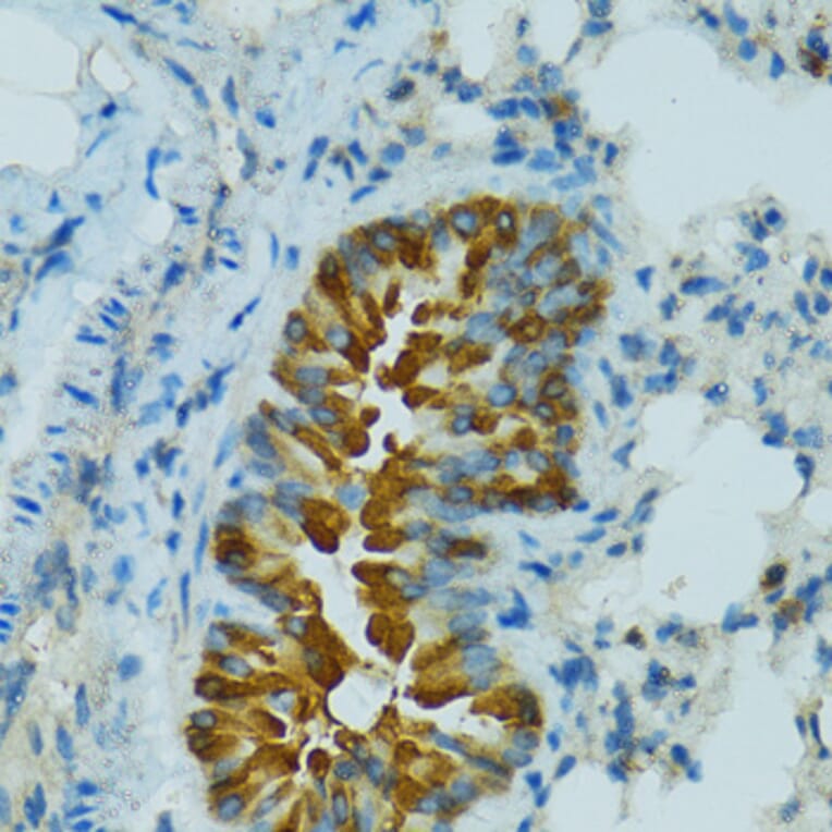 Immunohistochemistry - Anti-Cytochrome P450 2B6 / CYP2B6 Antibody (A11451) - Antibodies.com
