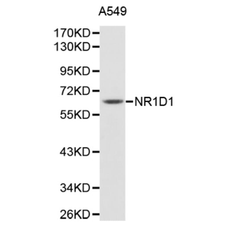 Western Blot - Anti-NR1D1 Antibody (A1478) - Antibodies.com