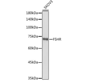 Western Blot - Anti-FSH-R Antibody (A11453) - Antibodies.com