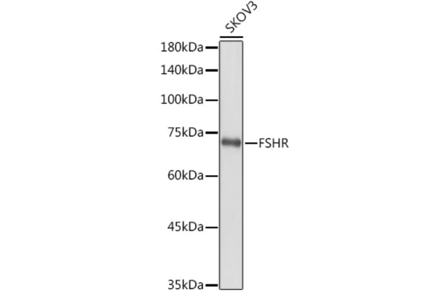 Western Blot - Anti-FSH-R Antibody (A11453) - Antibodies.com