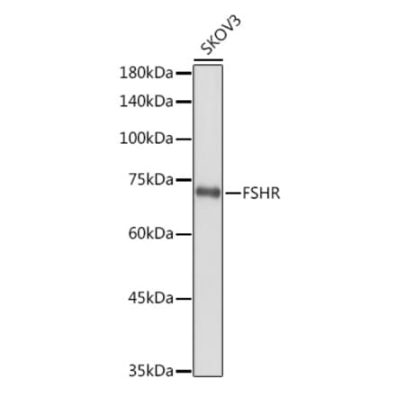 Western Blot - Anti-FSH-R Antibody (A11453) - Antibodies.com