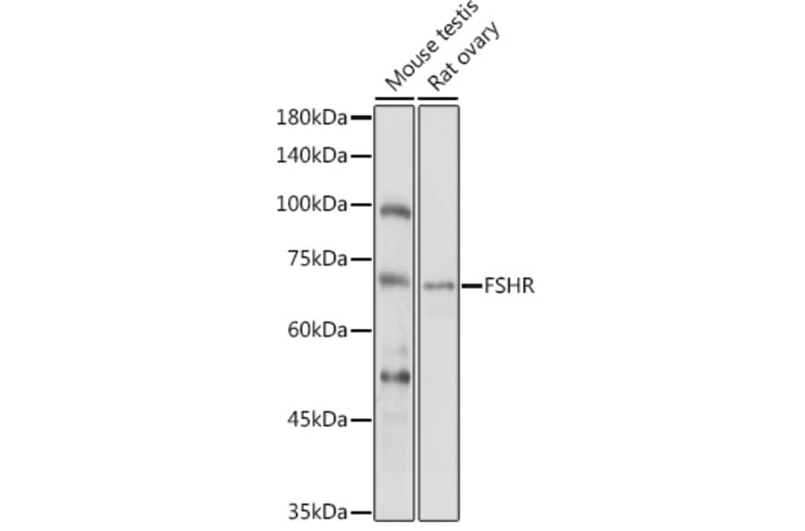 Western Blot - Anti-FSH-R Antibody (A11453) - Antibodies.com