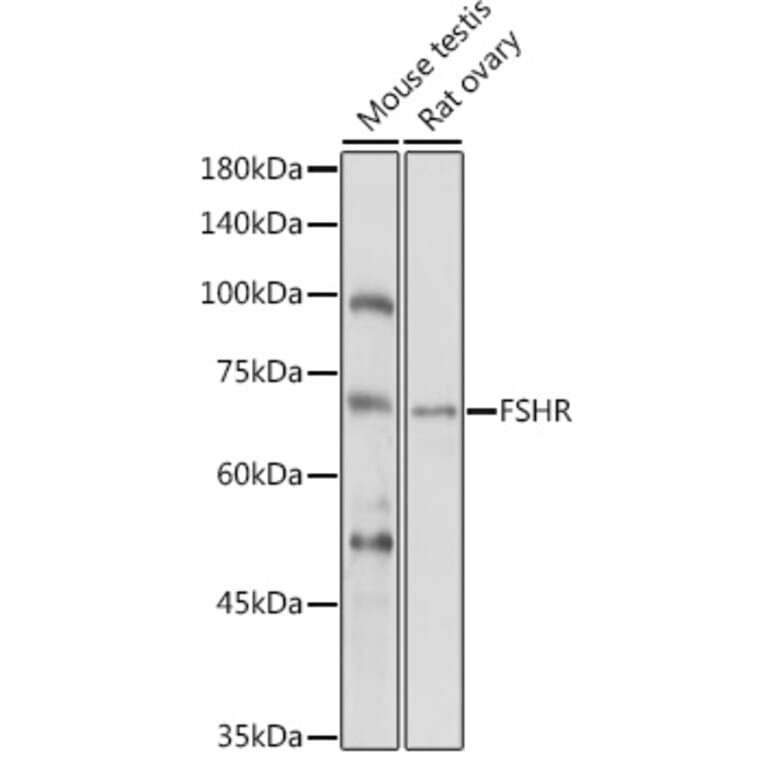 Western Blot - Anti-FSH-R Antibody (A11453) - Antibodies.com