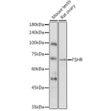 Western Blot - Anti-FSH-R Antibody (A11453) - Antibodies.com