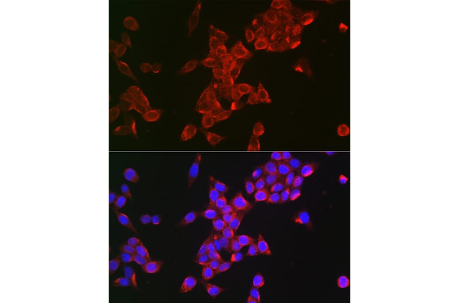 Immunofluorescence - Anti-FSH-R Antibody (A11453) - Antibodies.com