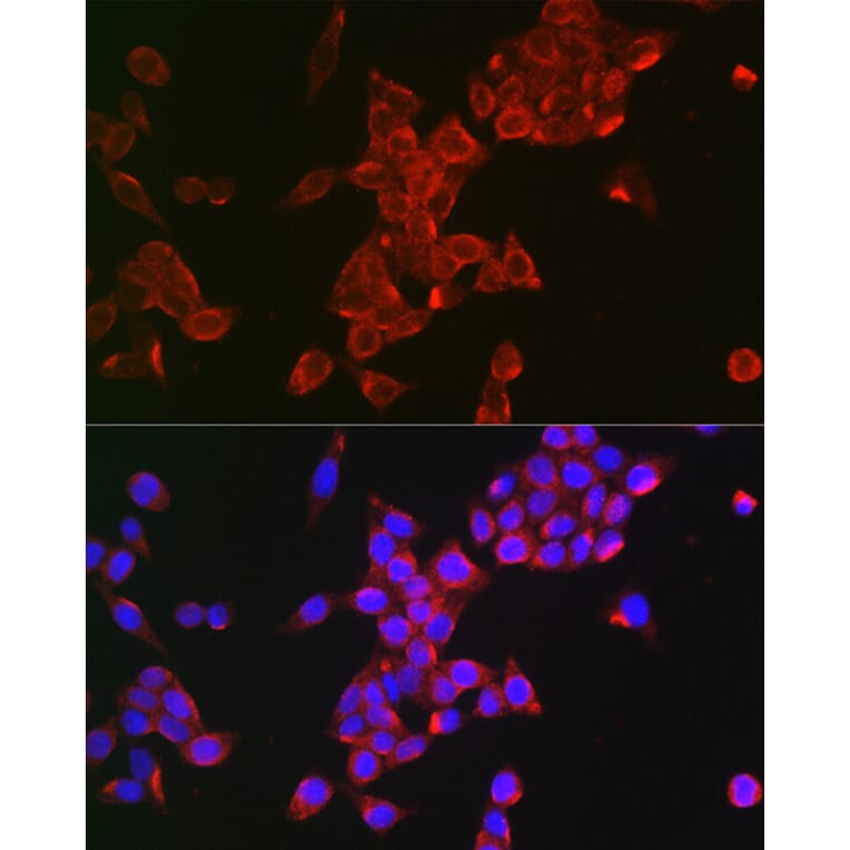 Immunofluorescence - Anti-FSH-R Antibody (A11453) - Antibodies.com