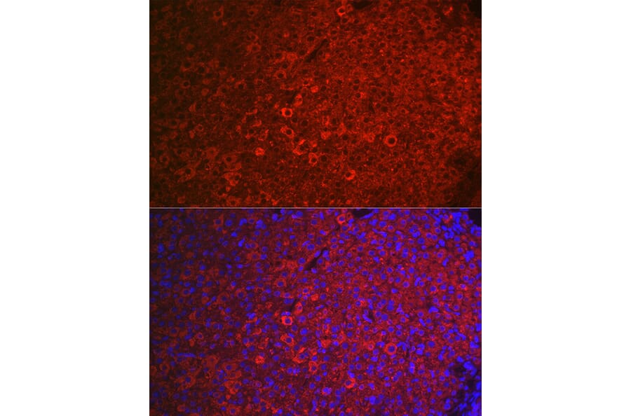Immunofluorescence - Anti-FSH-R Antibody (A11453) - Antibodies.com
