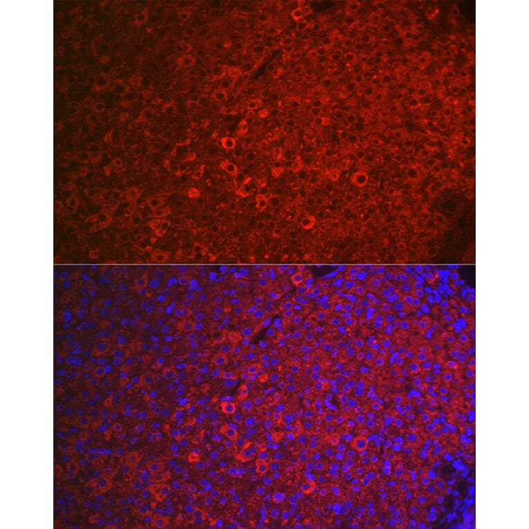 Immunofluorescence - Anti-FSH-R Antibody (A11453) - Antibodies.com
