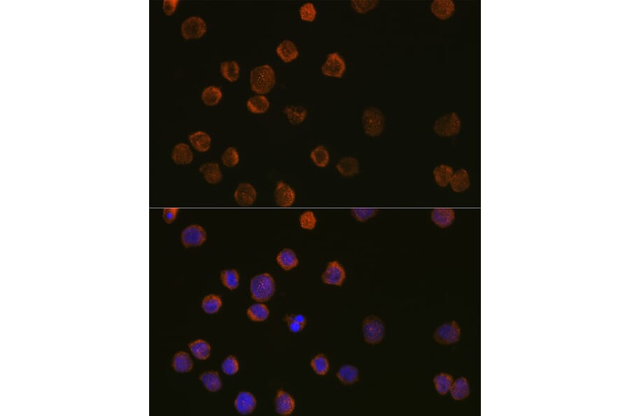 Immunofluorescence - Anti-CD11c Antibody (A11454) - Antibodies.com