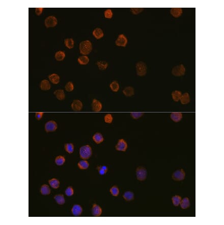 Immunofluorescence - Anti-CD11c Antibody (A11454) - Antibodies.com