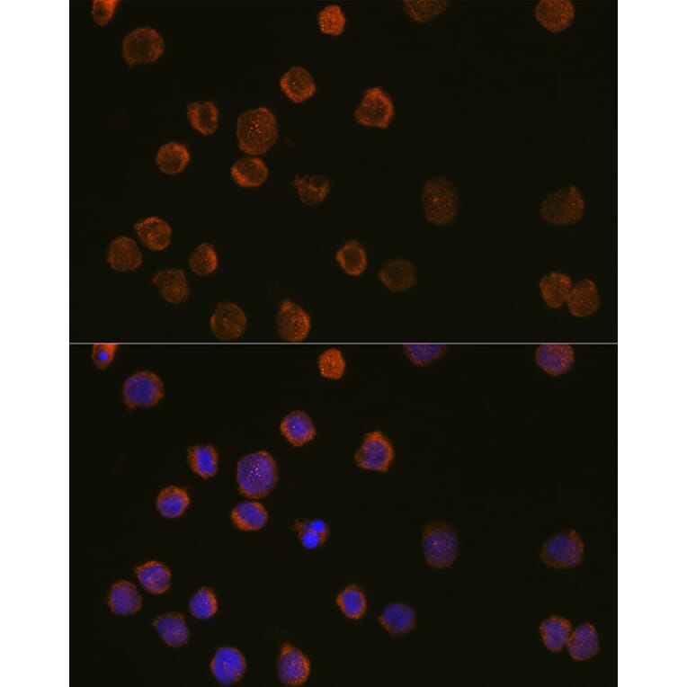 Immunofluorescence - Anti-CD11c Antibody (A11454) - Antibodies.com